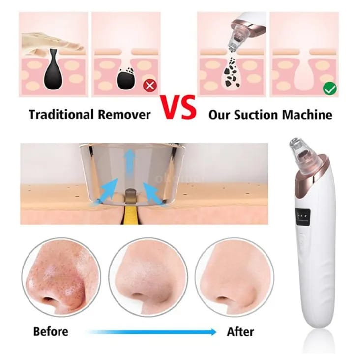 Face Vacuum Suction Blackhead Remover Pore Cleaner Electric Deep Cleansing